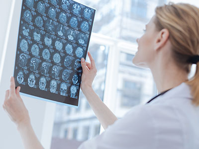 Neurosurgery Specialists