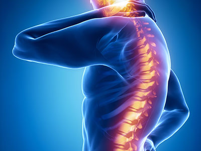 Minimal Invasive Spinal Surgery